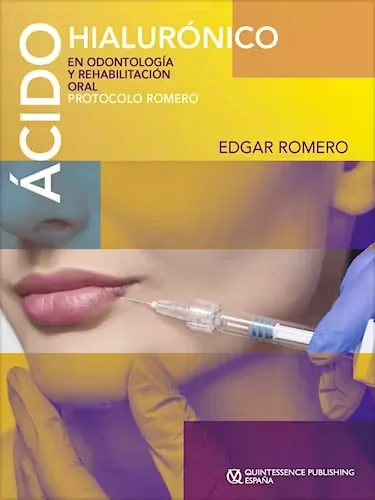 Ácido Hialurónico en Odontología y Rehabilitación Oral. Protocolo Romero