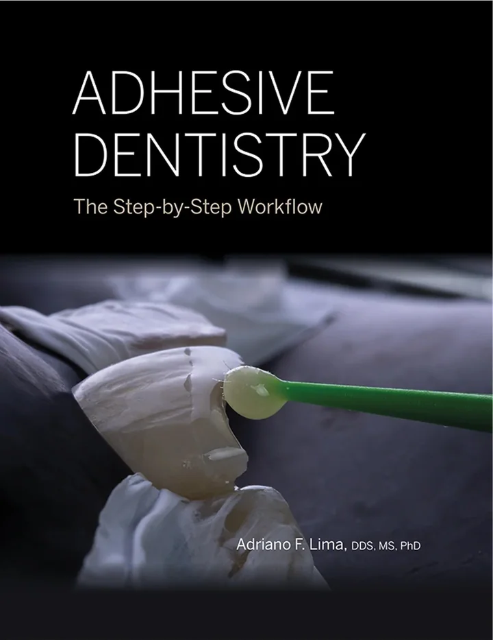Adhesive Dentistry: The Step-by-Step Workflow