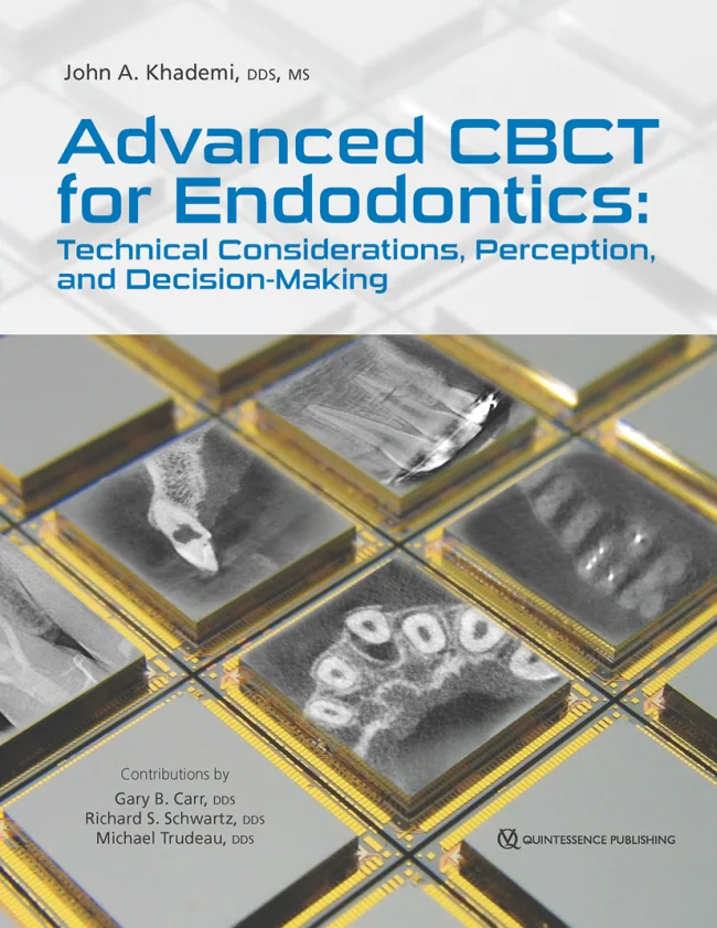 Advanced CBCT for Endodontics