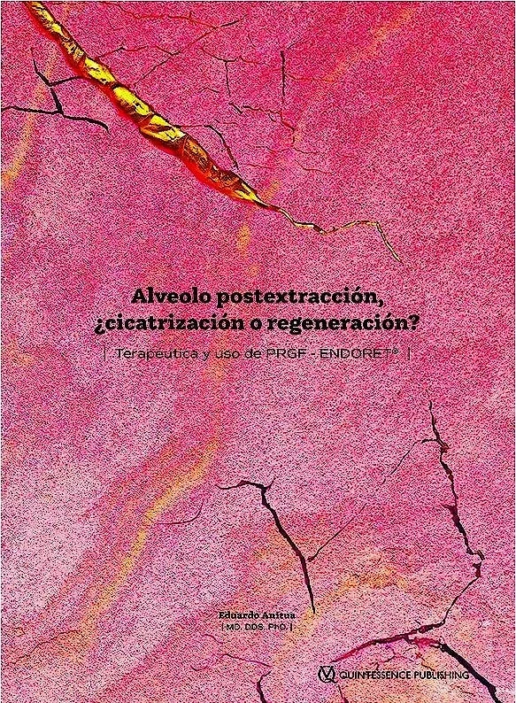 Alveolo Postextracción, ¿Cicatrización o Regeneración?