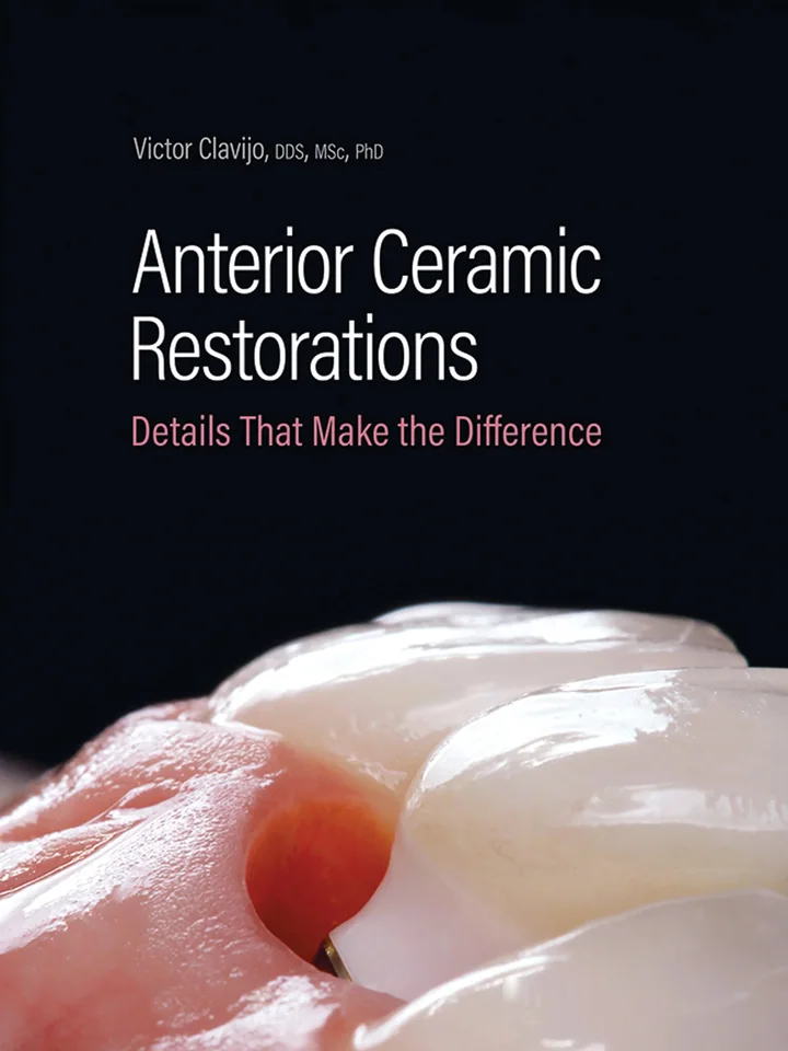Anterior Ceramic Restorations