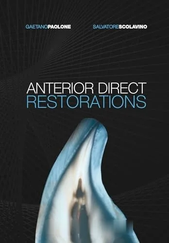 Anterior Direct Restorations