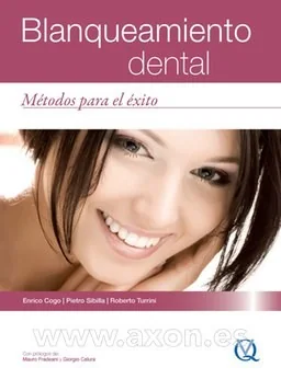 Blanqueamiento Dental, Métodos para el Éxito