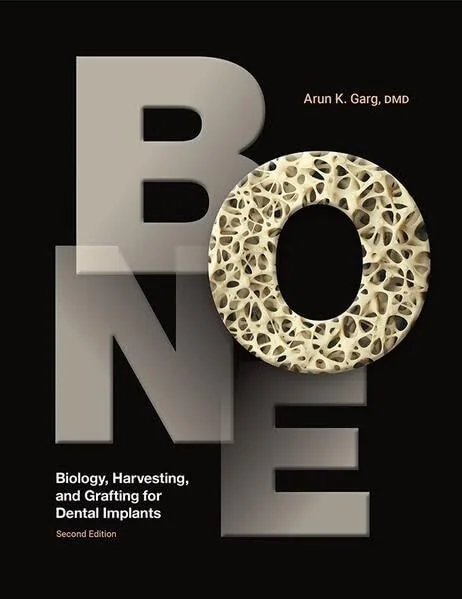 Bone: Biology, Harvesting, and Grafting for Dental Implants