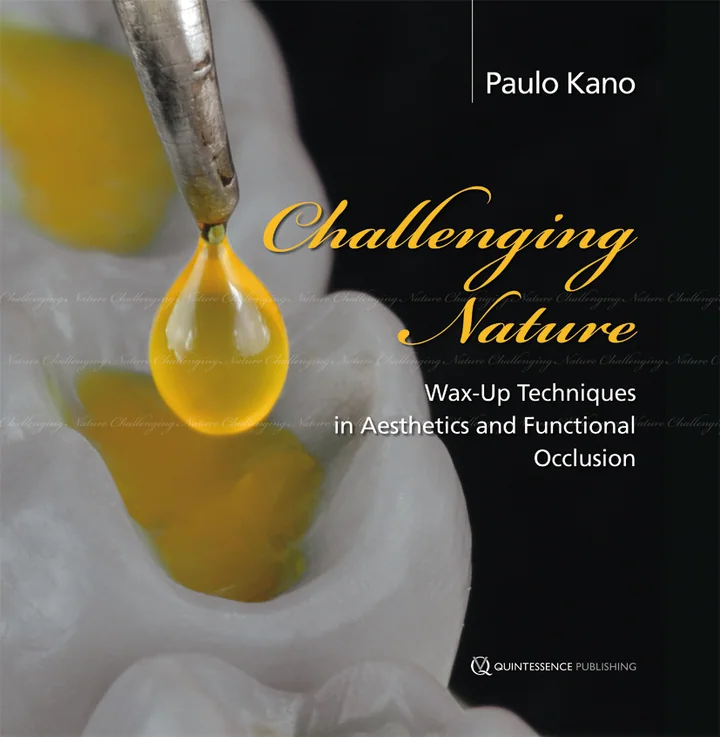 Challenging Nature: Wax-up Techniques in Aesthetics and Functional Occlusion