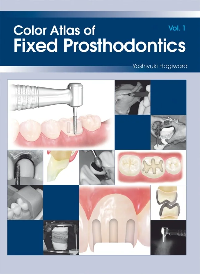 Color Atlas of Fixed Prosthodontics, Volume 1
