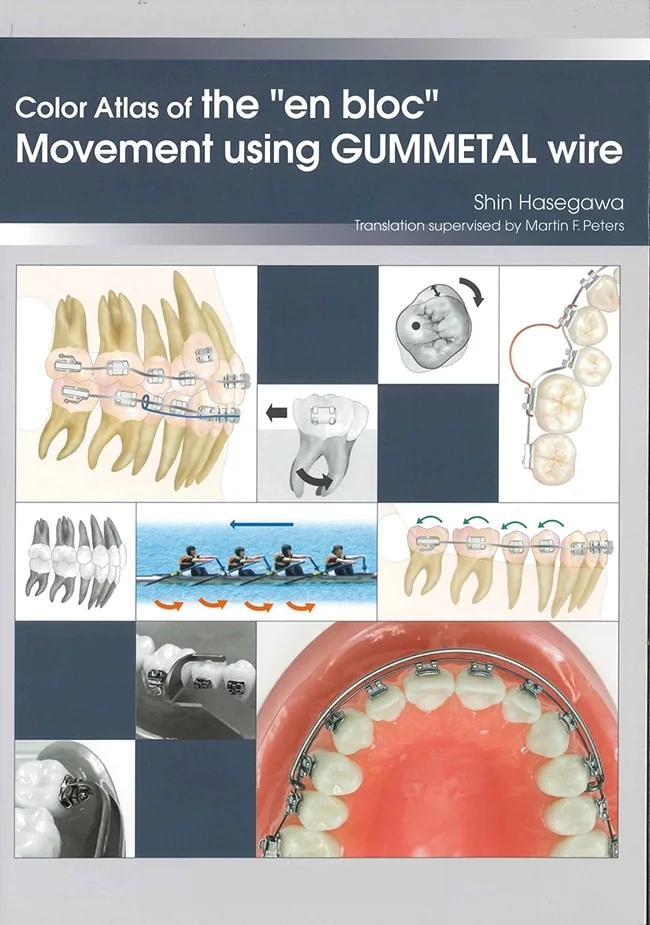 Color Atlas of the "en bloc" Movement Using GUMMETAL Wire