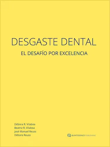 Desgaste Dental. El Desafío por Excelencia