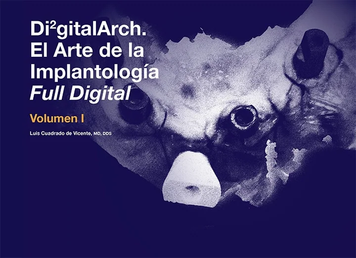 Di2gitalArch. El Arte de la Implantología Full Digital (2 volúmenes)
