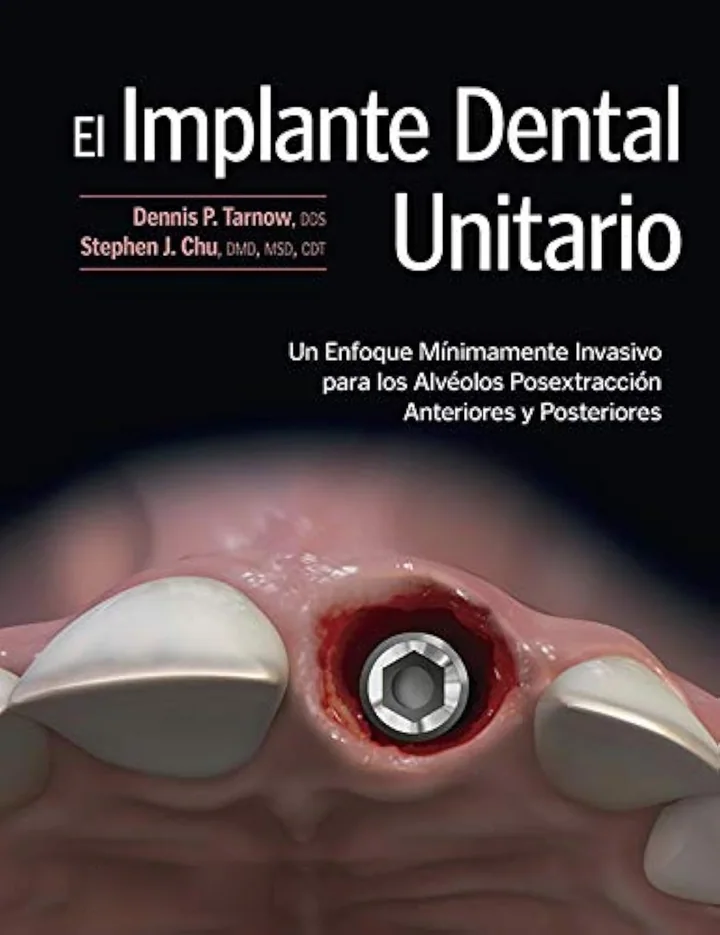 El Implante Dental Unitario. Un Enfoque Mínimamente Invasivo para los Alvéolos Posextracción Anteriores y Posteriores