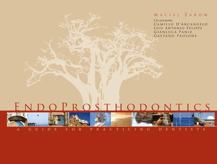 Endoprosthodontics: A Guide for Practicing Dentists
