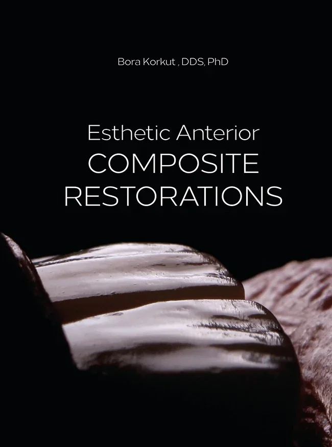 Esthetic Anterior Composite Restorations