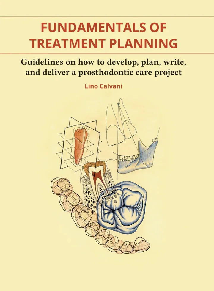 Fundamentals of Treatment Planning: Guidelines on How to Develop, Plan, Write, and Deliver a Prosthodontic Care Project