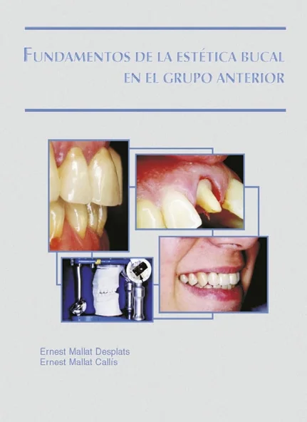 Fundamentos de la Estética Bucal en el Grupo Anterior