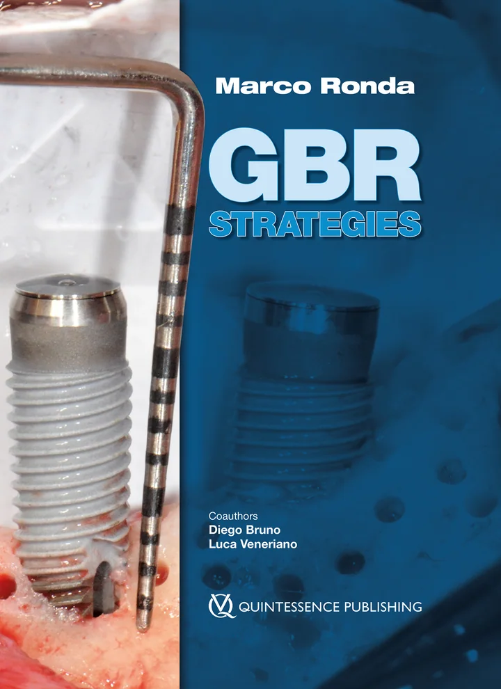 GBR Strategies