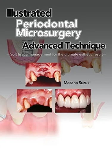 Illustrated Advanced Technique of Periodontal Microsurgery