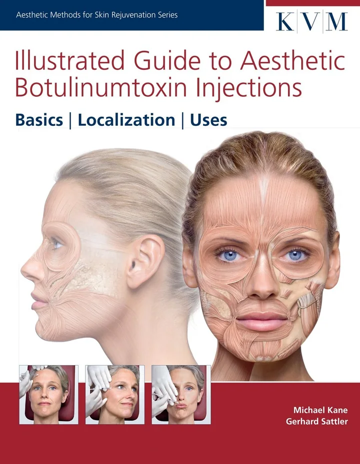 Illustrated Guide to Aesthetic Botulinumtoxin Injections