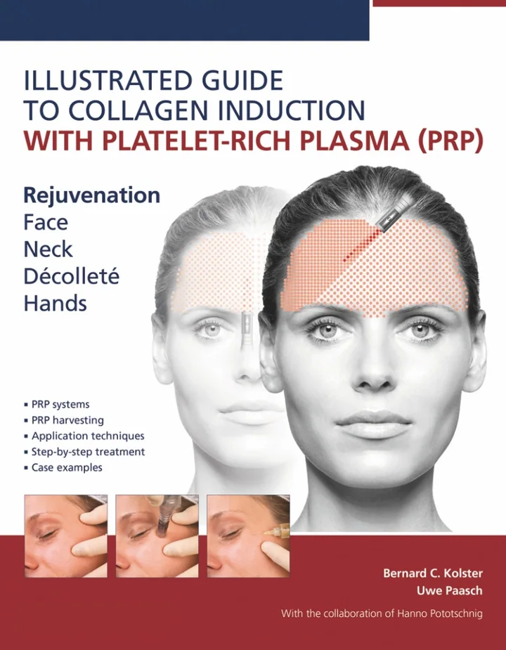 Illustrated Guide to Collagen Induction With Platelet-rich Plasma (PRP): Rejuvenation Face | Neck | Décolleté | Hands
