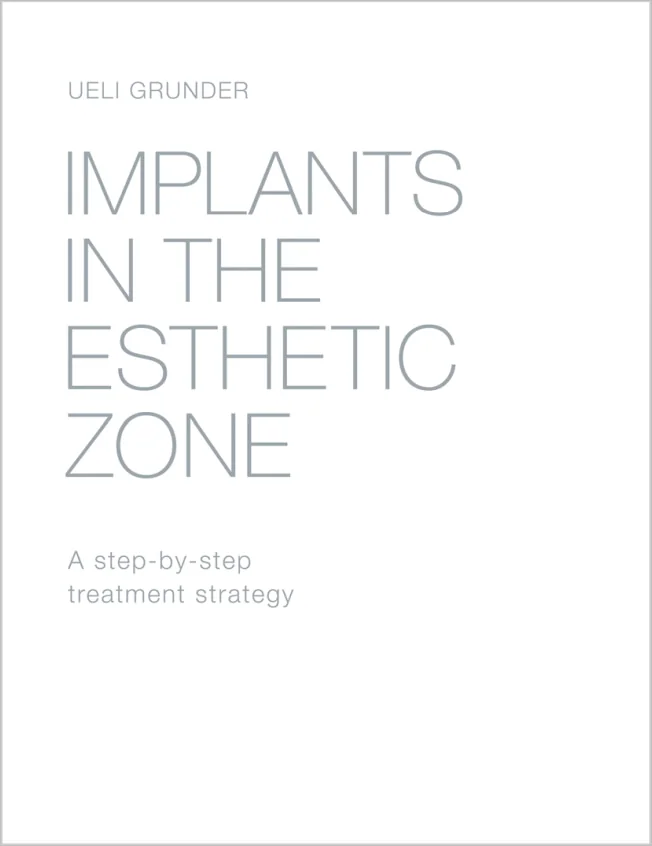 Implants in the Esthetic Zone: A Step-by-Step Treatment Strategy