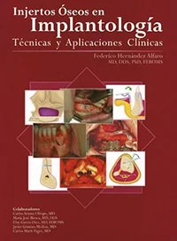 Injertos Óseos en Implantología: Técnicas y Aplicaciones Clínicas