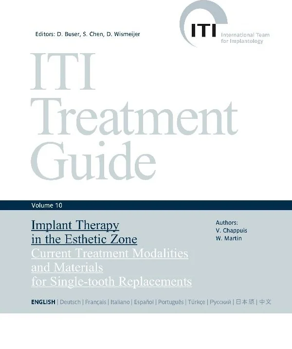 ITI Treatment Guide - Volume 10 — Implant Therapy in the Esthetic Zone
