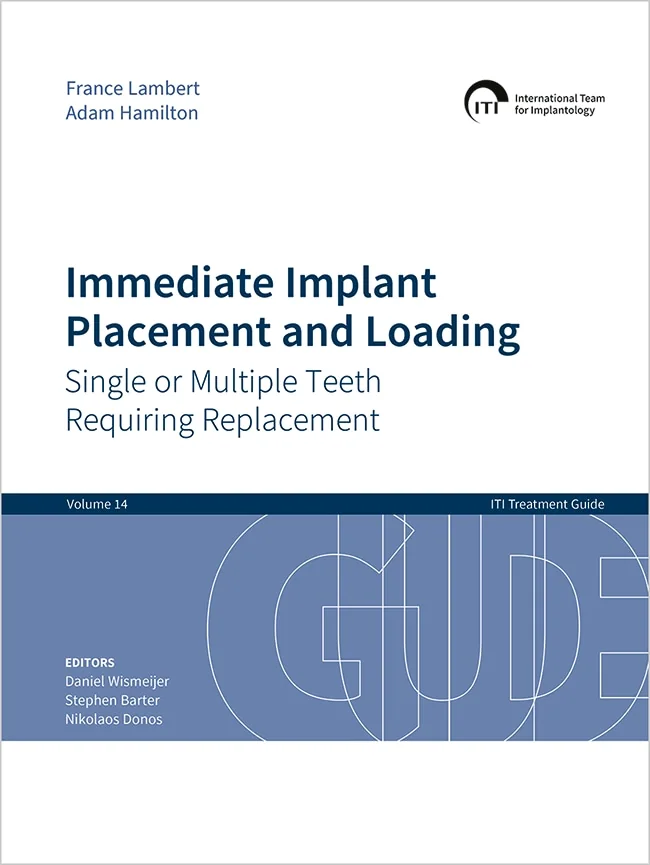 ITI Treatment Guide - Volume 14 - Immediate Implant Placement and Loading