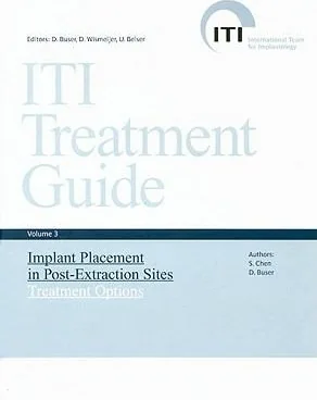ITI Treatment Guide - Volume 3 — Implant Placement in Post-extraction Sites: Treatment Options