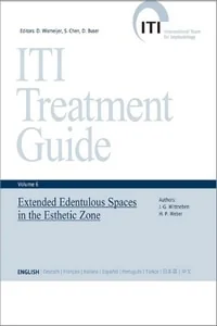 ITI Treatment Guide - Volume 6 — Extended Edentulous Spaces in the Esthetic Zone