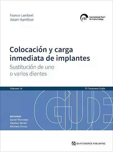 ITI Vol. 14 - Colocación y Carga Inmediata de Implantes. Sustitución de Uno o Varios Dientes