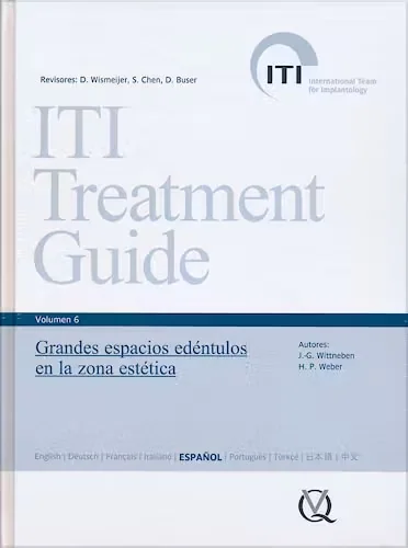 ITI Vol. 6 - Grandes Espacios Edéntulos en la Zona Estética