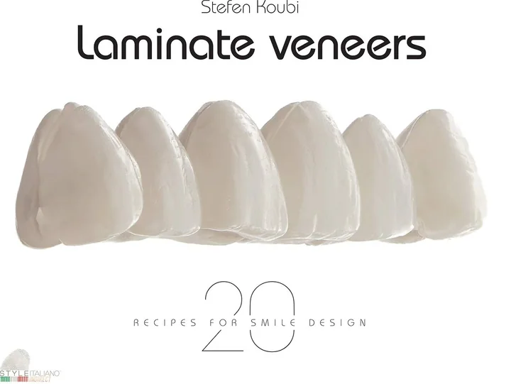 Laminate Veneers: 20 Recipes for Smile Design