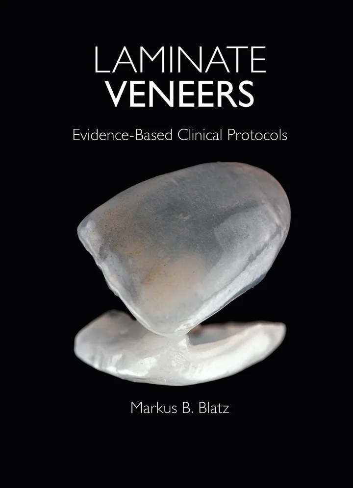 Laminate Veneers: Evidence-Based Clinical Protocols