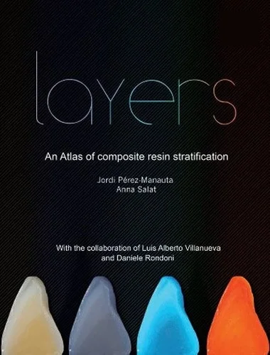 Layers, Un Atlas de Estratificación de Composites