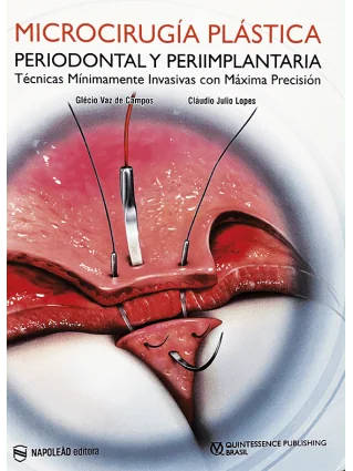 Microcirugía Plástica Periodontal y Periimplantaria