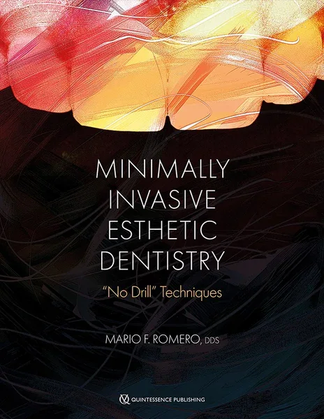 Minimally Invasive Esthetic Dentistry: "No Drill" Techniques