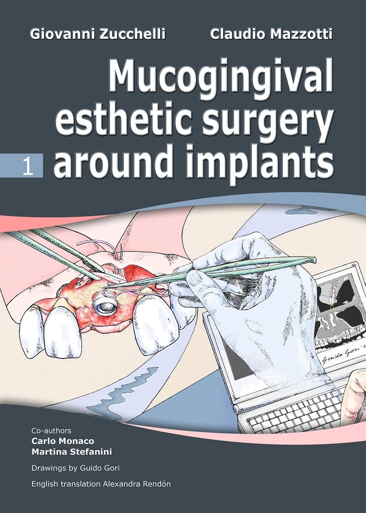 Mucogingival Esthetic Surgery Around Implants