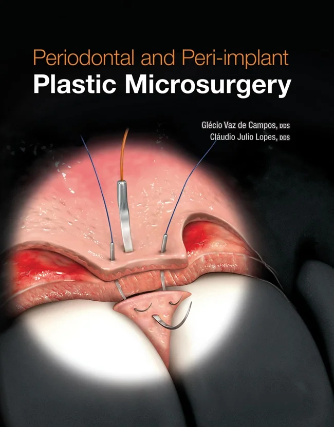 Periodontal and Peri-implant Plastic Microsurgery: Minimally Invasive Techniques With Maximum Precision