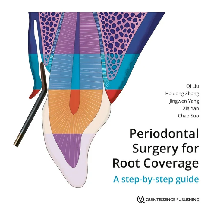 Periodontal Surgery for Root Coverage: A Step-by-step Guide