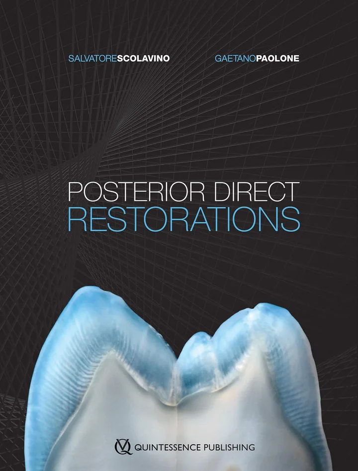 Posterior Direct Restorations