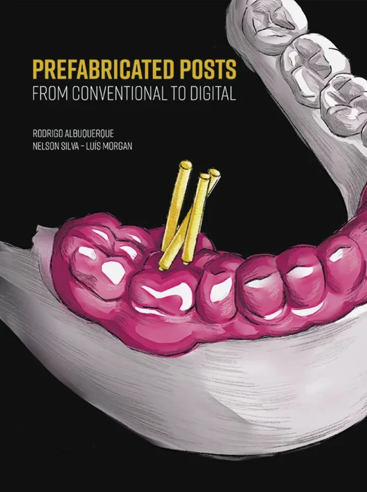 Prefabricated Posts: From Conventional to Digital