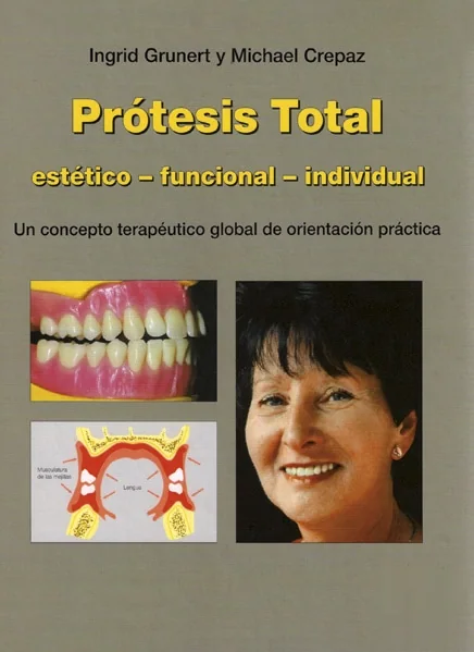 Prótesis Total