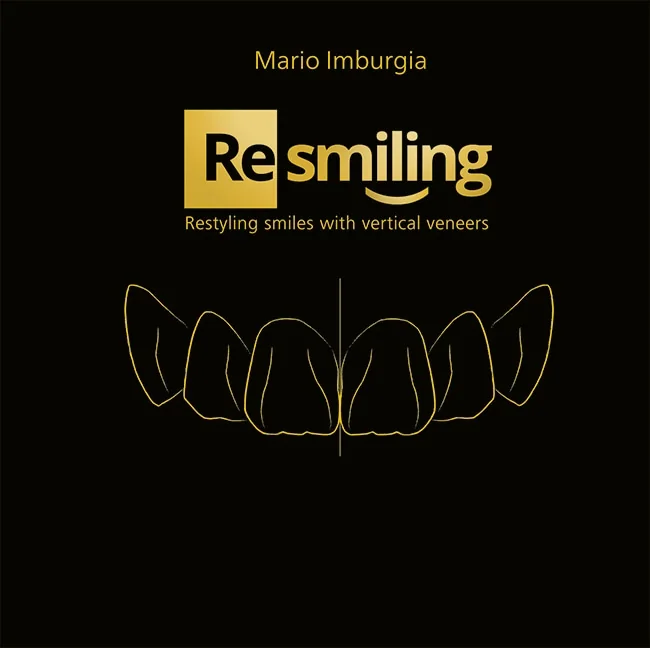 (Re)smiling: Restyling smiles with vertical veneers