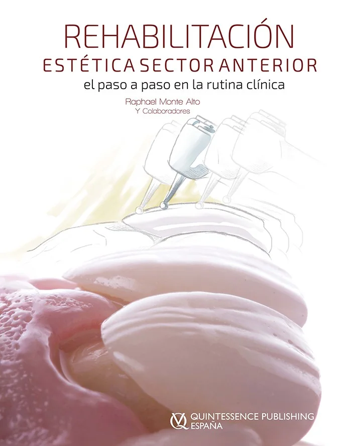 Rehabilitación Estética en el Sector Anterior - El Paso a Paso en la Rutina Clínica