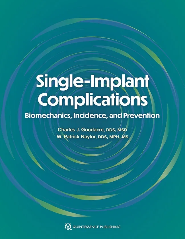 Single-Implant Complications: Biomechanics, Incidence, and Prevention