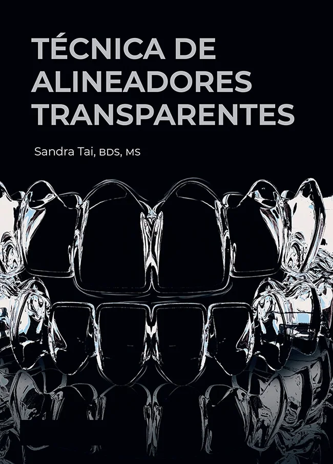 Técnica de Alineadores Transparentes