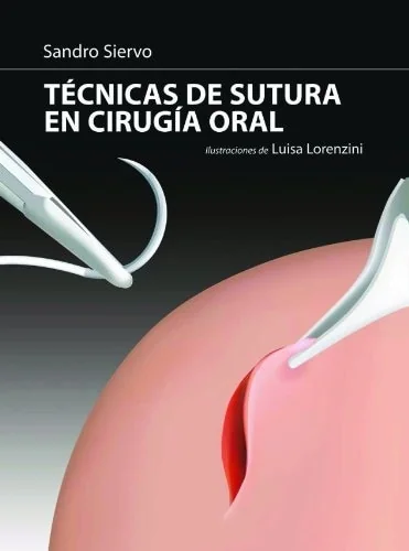 Técnicas de Sutura en Cirugía Oral