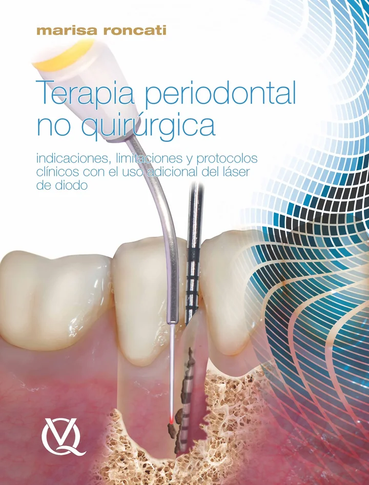 Terapia Periodontal No Quirúrgica