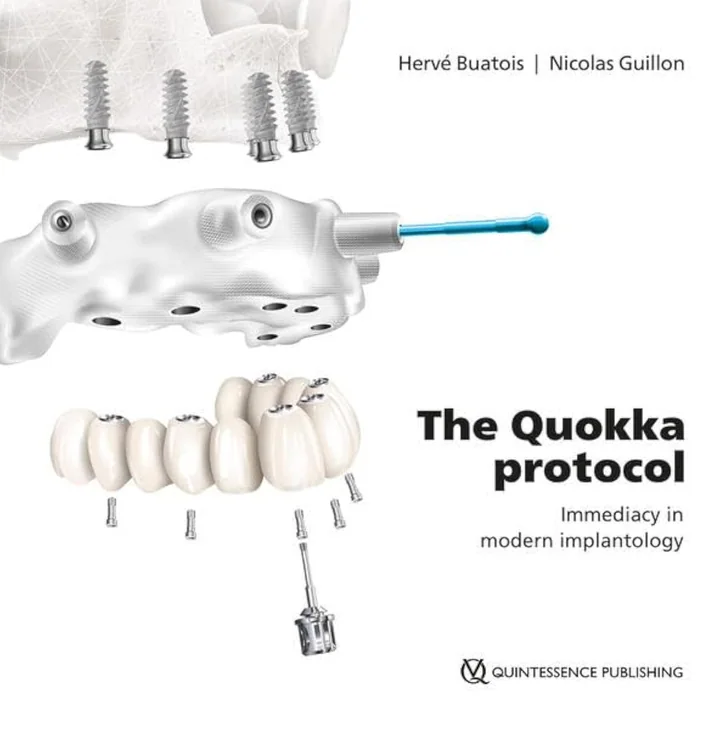 The Quokka Protocol: Immediacy in Modern Implantology