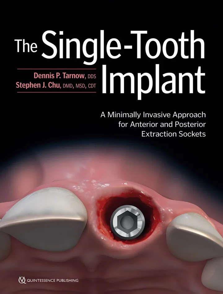 The Single-Tooth Implant: A Minimally Invasive Approach for Anterior and Posterior Extraction Sockets