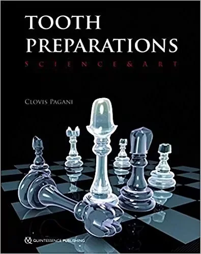 Tooth Preparations: Science & Art